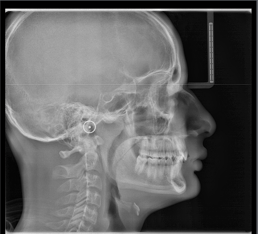 Radiografía Lateral